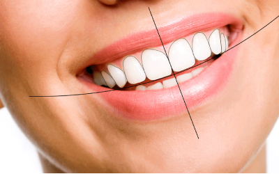 SMILE Designing SMILE Designing